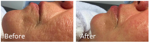 Screen Shot 2026-03-24 at 5.42.55 PM